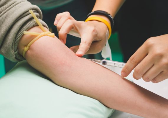 The phlebotomist’s guide to a less painful blood draw