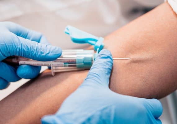 What is Phlebotomy, and Why Might You Need It? Miles Pharmacy Explains