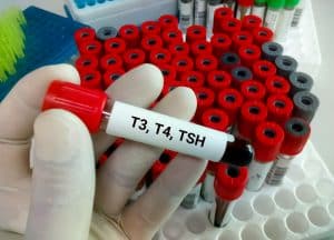 What is T4 blood test for?
