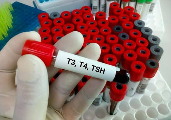 What is T4 blood test for?
